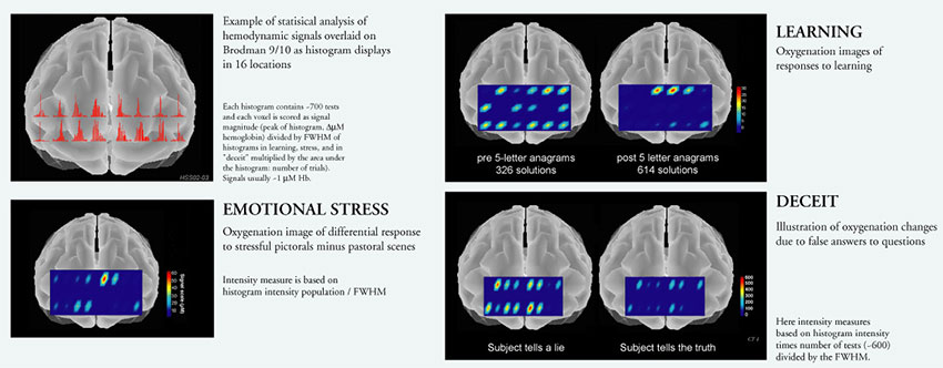 Center for Functional Neuroimaging images of typical brain function